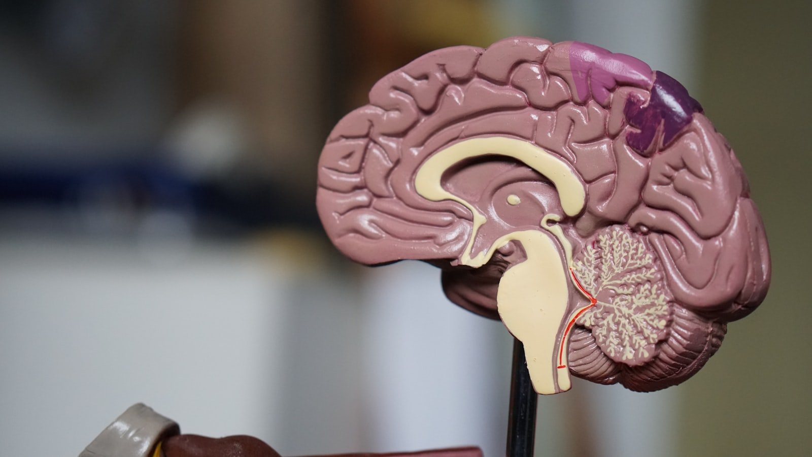 Phineas Gage: The Man Who Took an Iron Rod Through His Brain
